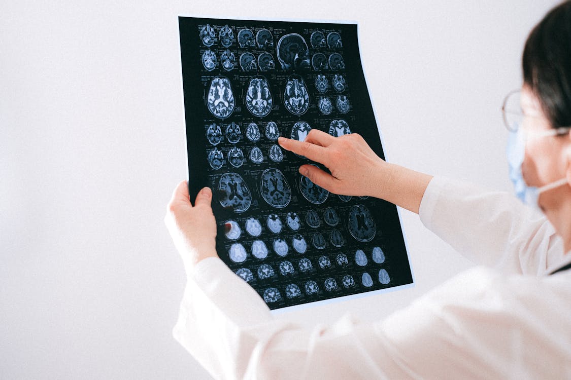 Practitioner examining brain MRI scans on a lightbox in a clinical setting